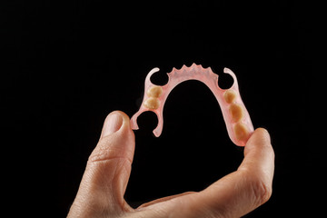 cast partial denture upper