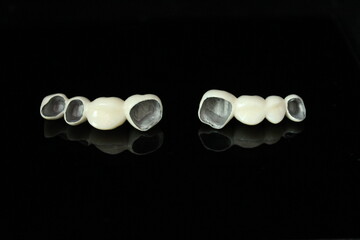 Dental Crowns