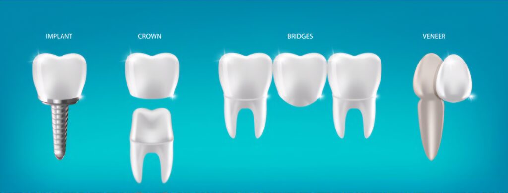 smile makeover treatment